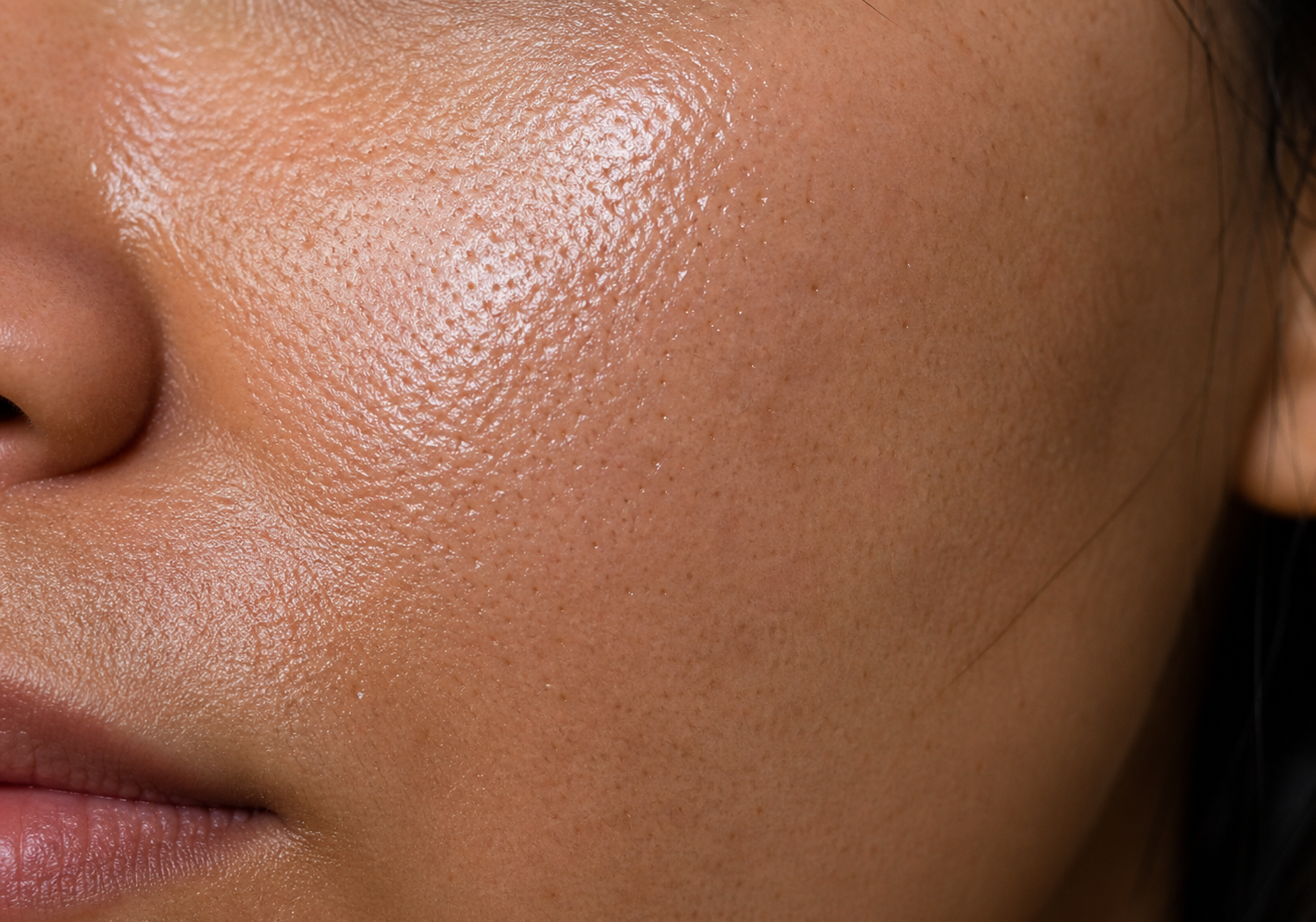 Oily Skin