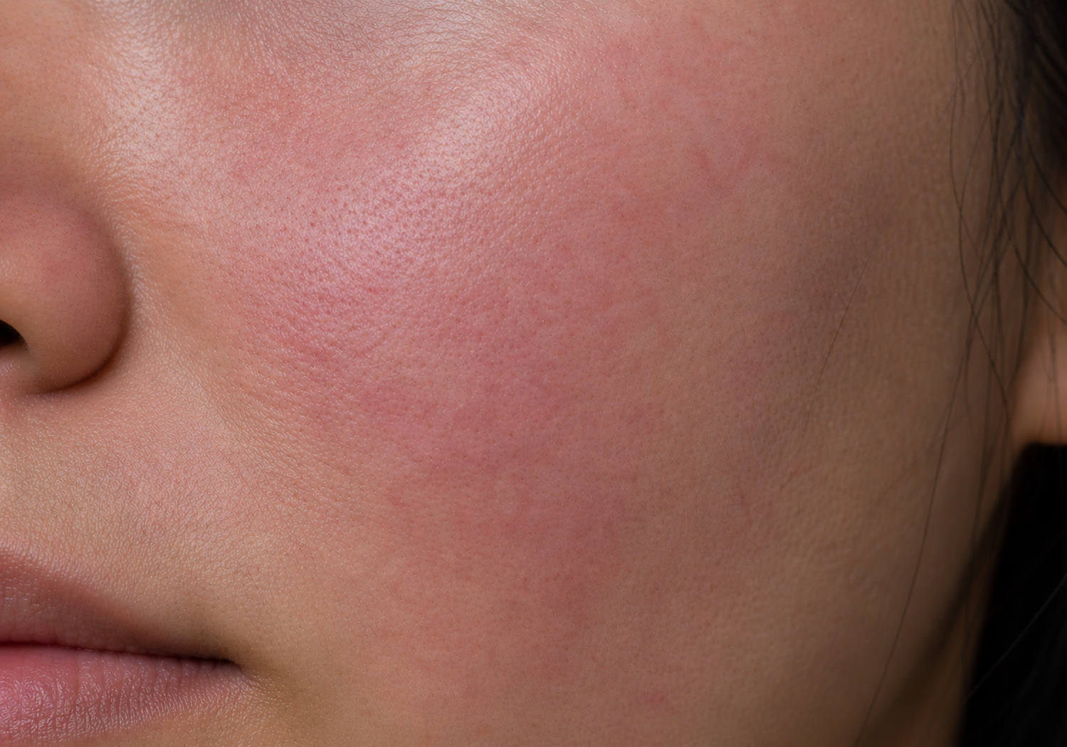Sensitive Skin